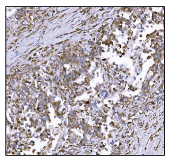 Anti-LRP1B Antibody