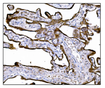 Anti-LRP1B Antibody
