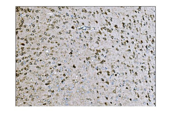 Anti-LRP1B Antibody