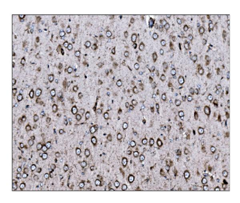 Anti-LRP1B Antibody