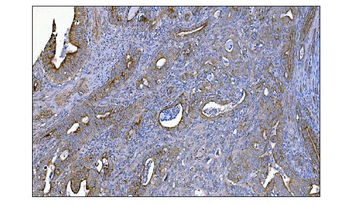 Anti-MERTK Antibody