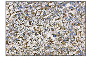 Anti-MERTK Antibody