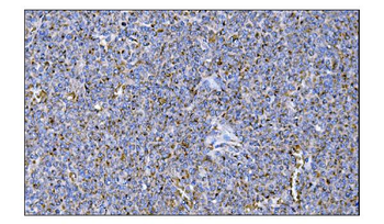 Anti-MERTK Antibody