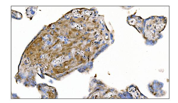 Anti-MERTK Antibody
