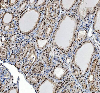 Anti-Ki67/Mki67 Antibody