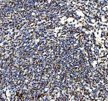 Anti-Ki67/Mki67 Antibody