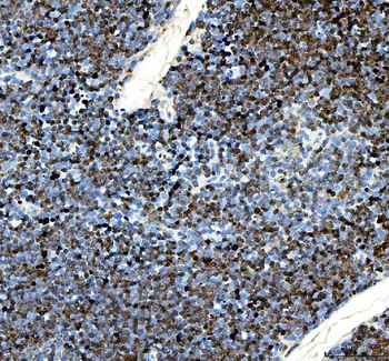 Anti-Ki67/Mki67 Antibody