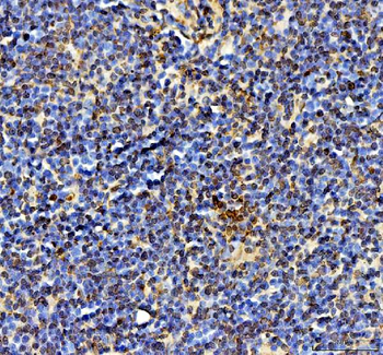 Anti-Ki67/Mki67 Antibody