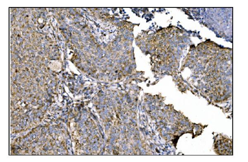 ornithine aminotransferase/OAT Antibody