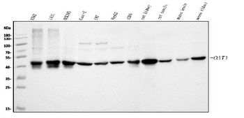 ornithine aminotransferase/OAT Antibody