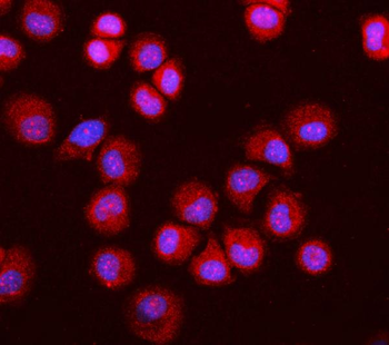 Anti-MGEA5/OGA Antibody