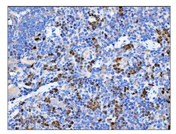 Anti-MGEA5/OGA Antibody