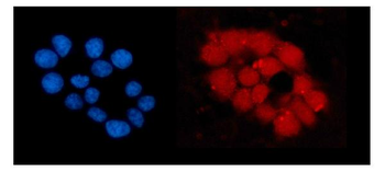 Anti-ORC5L/ORC5 Antibody