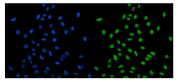 Anti-SCC112/PDS5A Antibody
