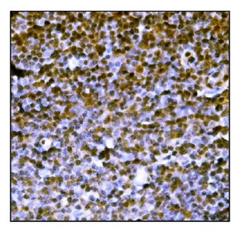 Anti-PML Protein/Pml Antibody