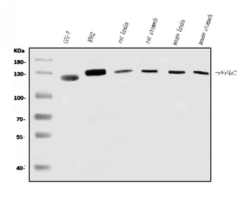 Anti-PPP4R1 Antibody