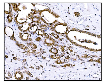 Anti-Prolyl Endopeptidase/PREP Antibody