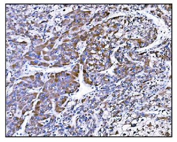 Anti-Prolyl Endopeptidase/PREP Antibody