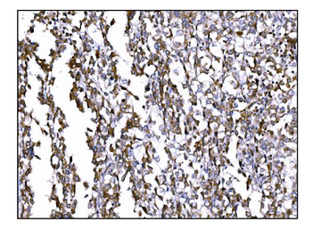 Anti-Prolyl Endopeptidase/PREP Antibody