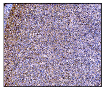 Anti-Prolyl Endopeptidase/PREP Antibody