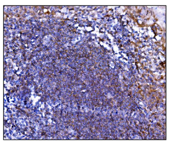 Anti-Prolyl Endopeptidase/PREP Antibody