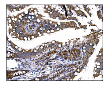 Anti-Prolyl Endopeptidase/PREP Antibody