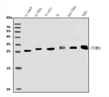 Anti-Psmb1 Antibody