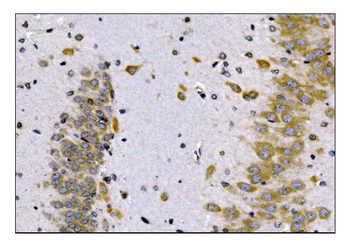 Anti-SCN1B Antibody