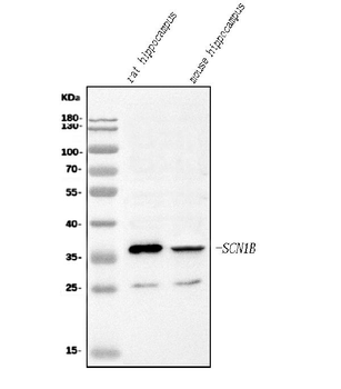 Anti-SCN1B Antibody