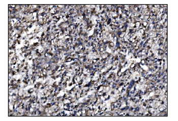 Anti-SLFN11 Antibody