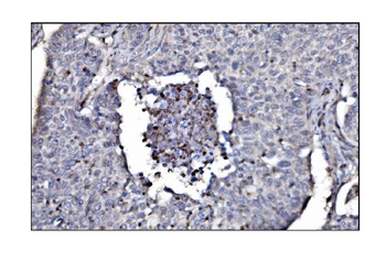 Anti-SLFN11 Antibody