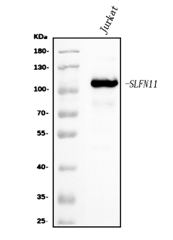 Anti-SLFN11 Antibody