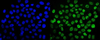 Anti-SUMO2/3 Antibody