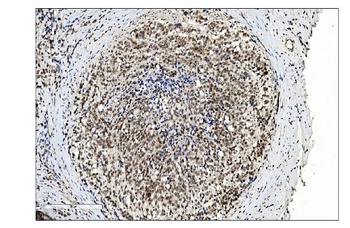 Anti-SUMO2/3 Antibody
