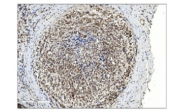 SUMO2/3 Antibody