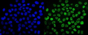 Anti-SUMO2/3 Antibody