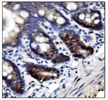 SUMO2/3 Antibody