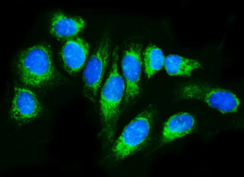 Anti-TRAP alpha/TRAPA/SSR1 Antibody