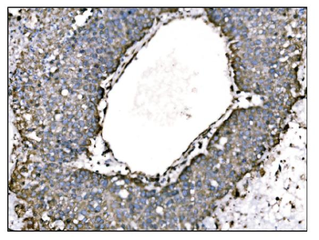 Anti-TRAP alpha/TRAPA/SSR1 Antibody