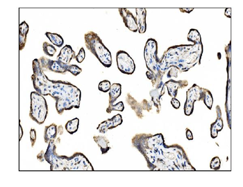 Anti-TRAP alpha/TRAPA/SSR1 Antibody
