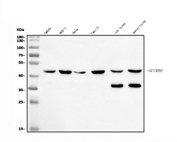 Anti-KMT1B/SUV39H2 Antibody