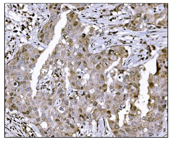 Anti-KMT1B/SUV39H2 Antibody