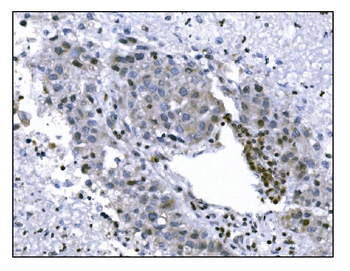 Anti-KMT1B/SUV39H2 Antibody