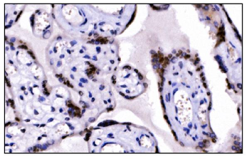 Anti-KMT1B/SUV39H2 Antibody