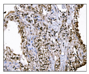 Anti-KMT1B/SUV39H2 Antibody