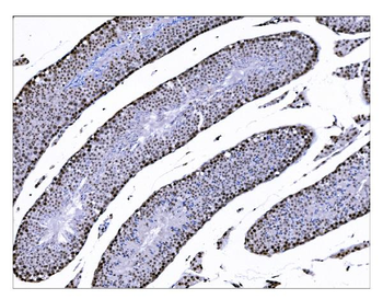Anti-KMT1B/SUV39H2 Antibody