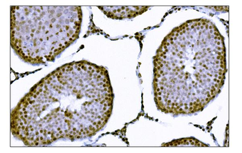 Anti-KMT1B/SUV39H2 Antibody