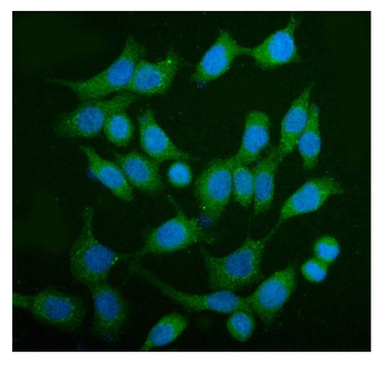 Anti-AS160/TBC1D4 Antibody