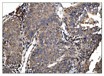 Anti-AS160/TBC1D4 Antibody
