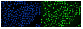Anti-Ki67 Antibody (monoclonal, 5E12)